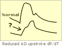 Arterial Pulse Trace